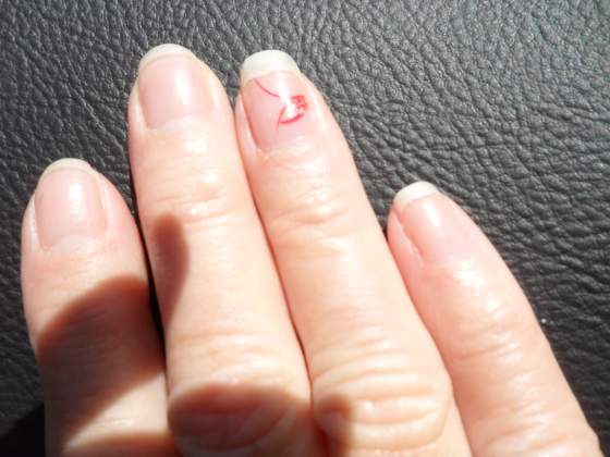 Does this look like a heart design to you ?